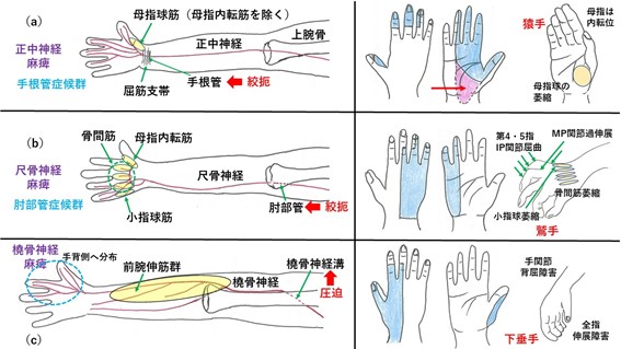 手が伸ばせない Dr Tomの徒然日記